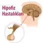 Hipofiz Hastalıkları Belirtileri ve Tedavisi